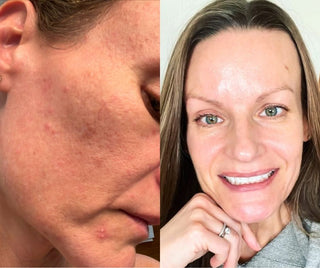 Apoterra Customer Testimonies: Shandi's Journey