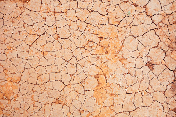 What You Need to Know About Dry Skin