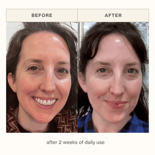 Before and after facial comparison of a woman showing skin improvement after 2 weeks of daily use of the Apoterra Chamomile Cream Cleanser