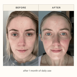 Before and after comparison of a woman's face showing skin improvement after 1 month of daily use of Apoterra Sea Berry Facial Oil, presented on a light beige background with 'BEFORE' and 'AFTER' labels.