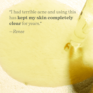 Apoterra Herbal Clarifying Facial Oil calms skin and reduces redness reports a customer review. 