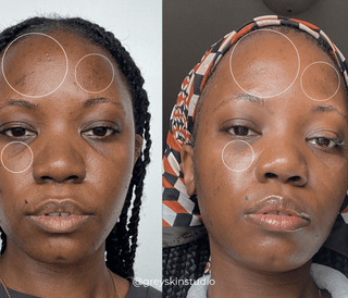 An Apoterra customer's before and after photos showing improved radiance and clarity after use of Apoterra clean skincare products