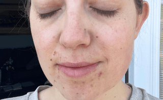 Close up of a woman's face prior to use of Apoterra clean skincare products