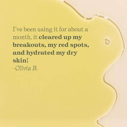 Vetiver Oil Cleanser by Apoterra customer review highlights cleared skin and reduction in red spots